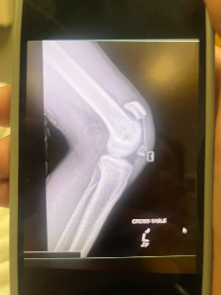 This image has an empty alt attribute; its file name is img_4214.jpeg